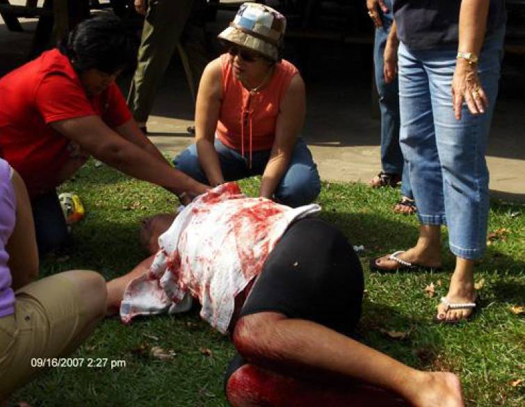 Man Attacked by Gator